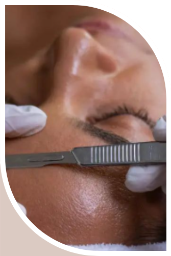 peeling mecanico